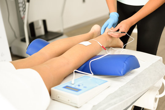 Electroacupuncture Dry With Needle On Female Ankle.