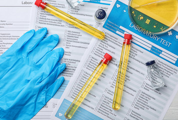Flat lay composition with laboratory equipment and urine samples on light background. Urology...