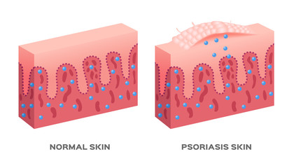 skin disease vector / psoriasis