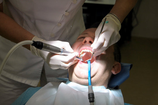 Dental Suction Images – Browse 1,383 Stock Photos, Vectors, and Video ...