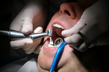 Dental check up. Dental male patient at regular dental check, at dental clinic and office. Man with dental suction tube in mouth. Healthcare and medical. Dentistry and oral hygiene. Dentist Concept.
