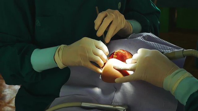 close up of hands doing inter dental cleaning on human teeth.