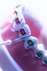 Interdental teeth brackets clean