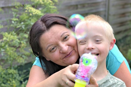 Defect,childcare,medicine and people concept- happy mother and son with down syndrome playing in a garden.
