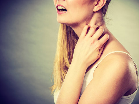 woman scratching her itchy neck with allergy rash