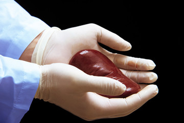 kidney transplant surgery concept. real kidney is in hands of transplant surgeon. cadaver, donor...