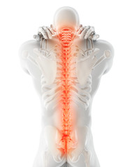 3D Illustration of sacral and cervical painful.