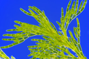 Fototapeta na wymiar Microscopic view of green algae (Cladophora)