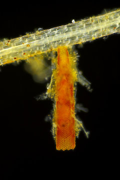 Microscopic view of unspecified eggs in tube shaped packet on Common duckweed (Lemna minor) root