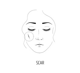 Cosmetology laser procedure for the removal of scars. The face of a girl