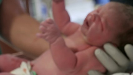 Beautiful newborn baby girl right after her birth getting looked at by doctors