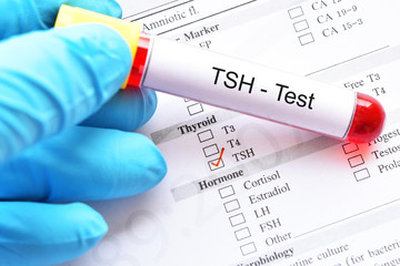 Blood sample tube with laboratory requisition form for thyroid stimulating hormone (TSH) test