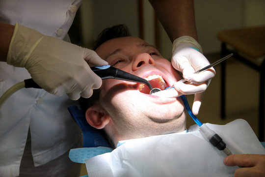 Dental tool for rinsing teeth. Teeth cleaning, dental hygiene. Dentist at work in his dentist clinic and office is rinsing of patient teeth with mirror, cleaning tool spray and suction tube in mouth.