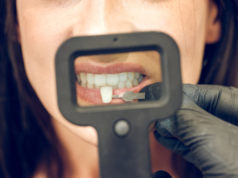 Dentist picking color of denture