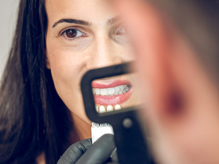 Dentist picking color of denture