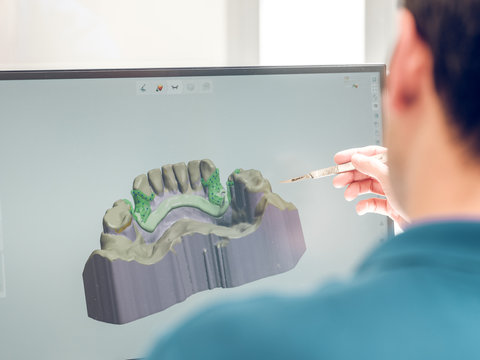 Dentist modeling jaw on computer