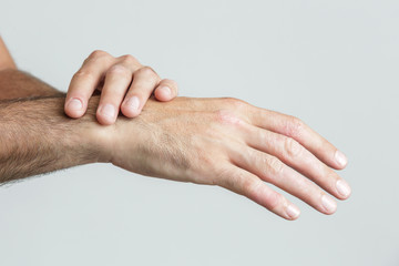 Fototapeta premium Wrist injury, man with Carpal tunnel syndrome symptom