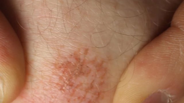 A man touches a wound on his knee