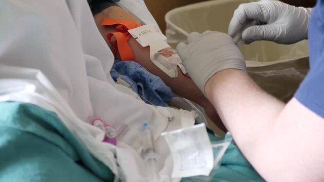 Nurse putting an IV into a womans arm to get blood at the hospital