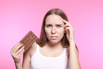 Young woman with acne problem holding chocolate bar on color background. Skin allergy
