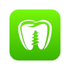 Denture implant icon. Simple illustration of denture implant vector icon for web