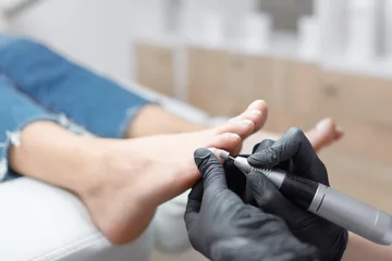Wandcirkels plexiglas Doctor in gloves making procedure for foot with special equipment. © IEGOR LIASHENKO
