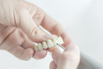 Laboratory dentist technician working on prostetic tooth close