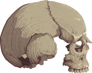 skull in profile