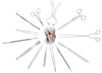 Medical surgical instruments around the human diseased knee joint - scalpel, scissors, forceps, lancet, chisel, knife. Medicine and healthcare concept, isolated on white. 3D illustration	