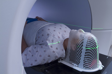 Woman Receiving Radiation Therapy Treatments for Brain Tumor (Cancer)