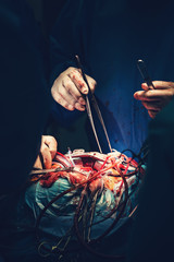 Surgical nurse pick up sterile instrument in the surgery operation room in hospital processing...