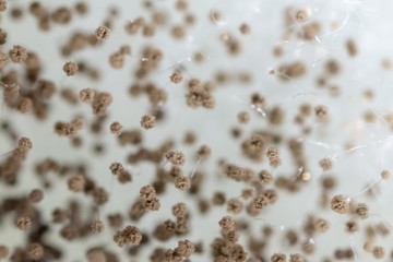 Rhizopus (bread mold) is a genus of common saprophytic fungi,Rhizopus (bread mold) under the microscope.