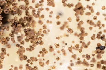 Rhizopus (bread mold) is a genus of common saprophytic fungi,Rhizopus (bread mold) under the microscope.