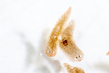 Planarian parasite (flatworm) under microscope view.