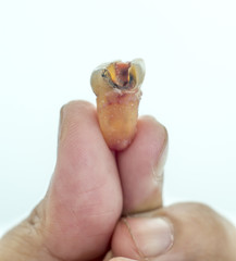 decay molar tooth in a human hand on a white background