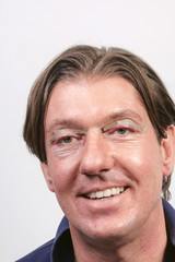 Fototapeta premium Man happy after eyelid surgery