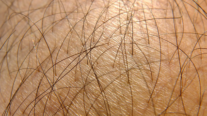 hairy leg of a man - closeup