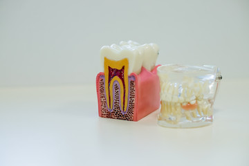White teeth model and tooth model without caries on white background. Dental care concept.
