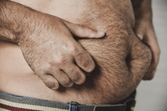 man grabbing the fat of his stomach