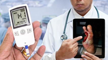 Doctor showing picture of diabetic foot ulcer (wound) on tablet computer in operation room with hand holding blood glucose meter showing High level of blood glucose.