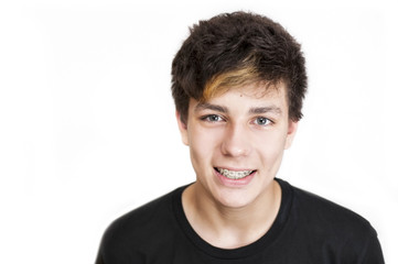 A teenager with a dark, painted hair on a white background smiles. On two of his jaws are braces. Dental concept