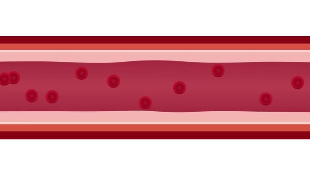 hypertension , high blood pressure / human anatomy graphic animation