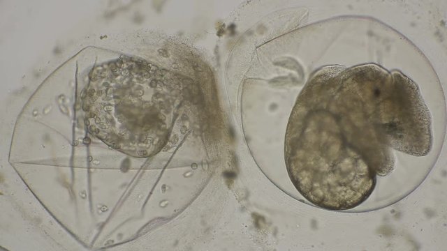 eggs of Planorbis snails with already developed embryo and dead eggs, infected with infusoria etrahymena pyriformis under a microscope