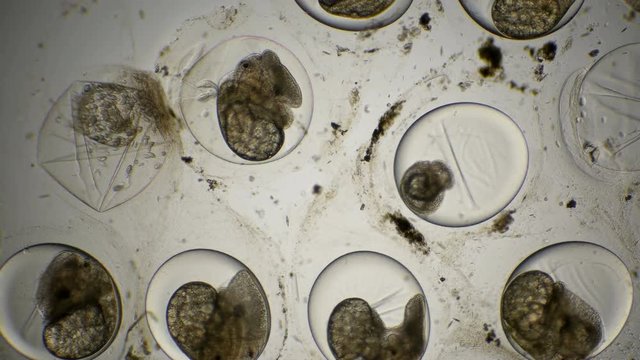 eggs of Planorbis snails with already developed embryo and dead eggs, infected with infusoria etrahymena pyriformis under a microscope