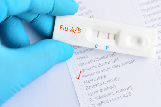 Influenza A/B positive test result by using rapid test cassette
