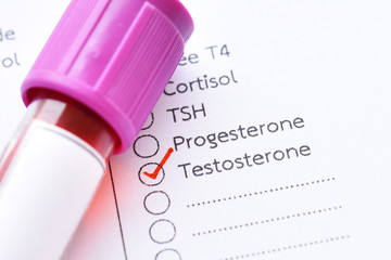Blood sample with laboratory requisition form for testosterone hormone test 