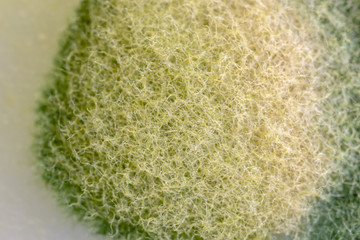 Backgrounds of Colony Characteristics of Fungus and algae in petri dish for education.