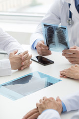 Group of doctors discuss x-ray