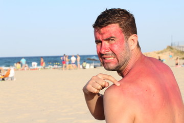 Man overexposing his skin to the sun 