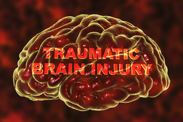 Traumatic injury of human brain, 3D illustration. Conceptual image showing the brain and traumatic brain injury text